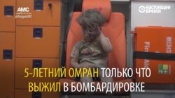 Ад в Алеппо: как выглядят те, кто выжил в бомбардировках